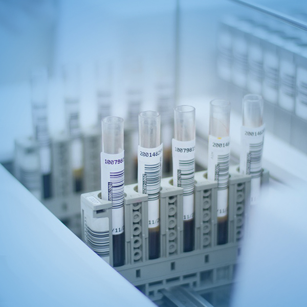 液體處理工作站翻蓋驅動系統應用 液體處理工作站翻蓋驅動系統應用